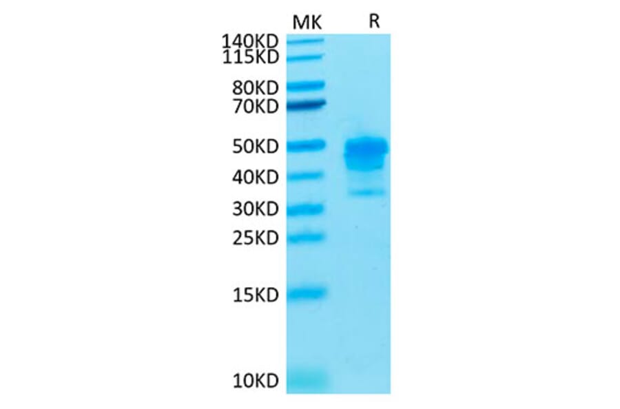 Tris-Bis PAGE - Recombinant Cynomolgus macaque Mesothelin Protein (C-terminal His Tag) (A331046) - Antibodies.com