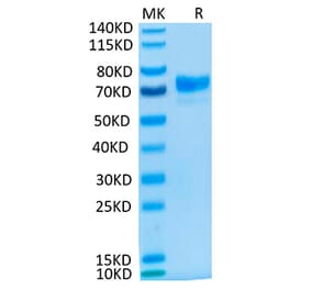 Tris-Bis PAGE - Recombinant Cynomolgus macaque Mesothelin Protein (C-terminal Human Fc Tag) (A331047) - Antibodies.com