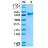 Tris-Bis PAGE - Recombinant Cynomolgus macaque Mesothelin Protein (C-terminal Human Fc Tag) (A331047) - Antibodies.com