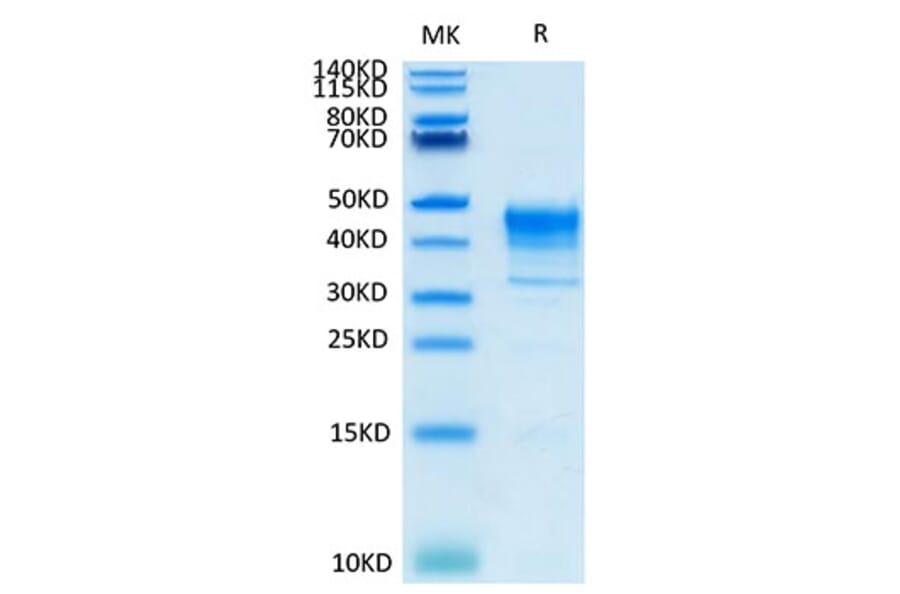 Tris-Bis PAGE - Recombinant Cynomolgus macaque Mesothelin Protein (Biotin) (C-terminal His Tag) (A331048) - Antibodies.com