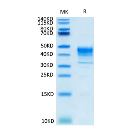 Tris-Bis PAGE - Recombinant Cynomolgus macaque Mesothelin Protein (Biotin) (C-terminal His Tag) (A331048) - Antibodies.com