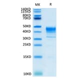 Tris-Bis PAGE - Recombinant Cynomolgus macaque Mesothelin Protein (Biotin) (C-terminal His Tag) (A331048) - Antibodies.com
