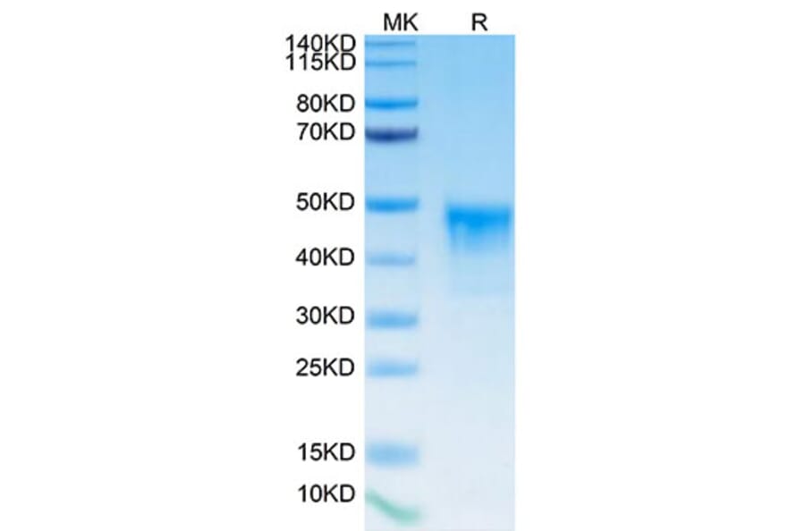 Tris-Bis PAGE - Recombinant Human Mesothelin Protein (Biotin) (C-terminal His and Avi Tag) (A331049) - Antibodies.com