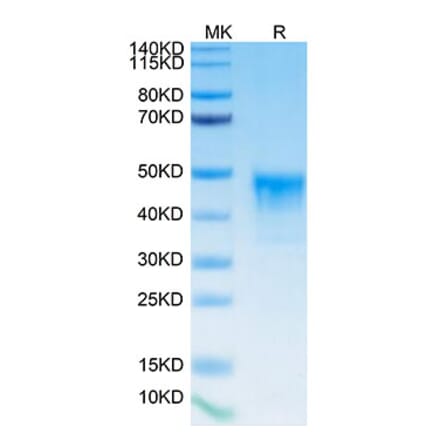 Tris-Bis PAGE - Recombinant Human Mesothelin Protein (Biotin) (C-terminal His and Avi Tag) (A331049) - Antibodies.com