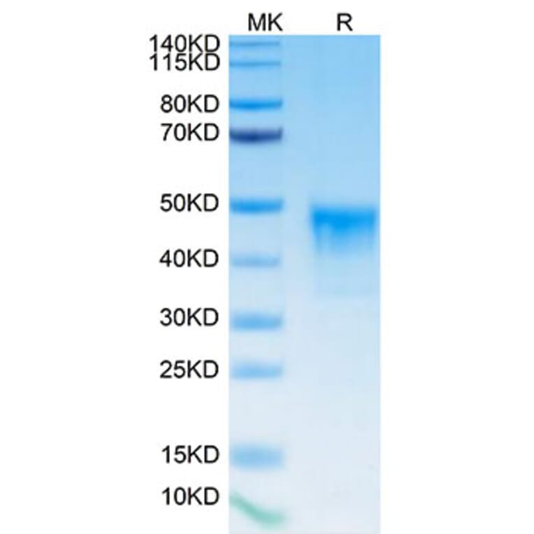 Tris-Bis PAGE - Recombinant Human Mesothelin Protein (Biotin) (C-terminal His and Avi Tag) (A331049) - Antibodies.com