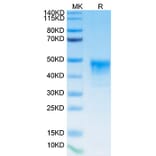 Tris-Bis PAGE - Recombinant Human Mesothelin Protein (Biotin) (C-terminal His and Avi Tag) (A331049) - Antibodies.com