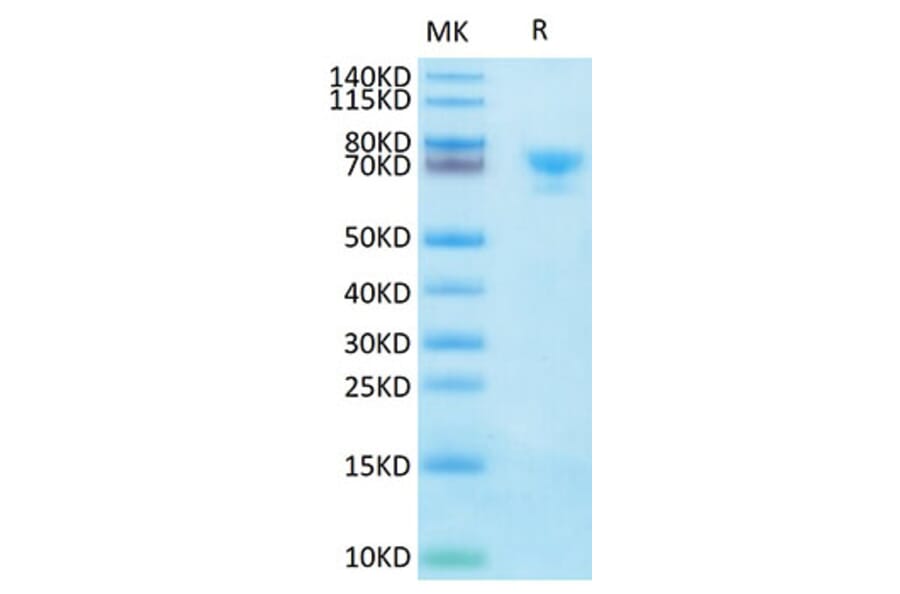 Tris-Bis PAGE - Recombinant Human Mesothelin Protein (Biotin) (C-terminal Human Fc and Avi Tag) (A331050) - Antibodies.com