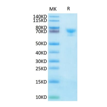 Tris-Bis PAGE - Recombinant Human Mesothelin Protein (Biotin) (C-terminal Human Fc and Avi Tag) (A331050) - Antibodies.com