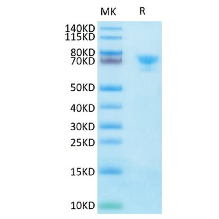 Tris-Bis PAGE - Recombinant Human Mesothelin Protein (Biotin) (C-terminal Human Fc and Avi Tag) (A331050) - Antibodies.com