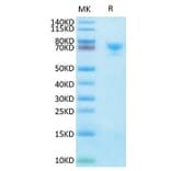 Tris-Bis PAGE - Recombinant Human Mesothelin Protein (Biotin) (C-terminal Human Fc and Avi Tag) (A331050) - Antibodies.com