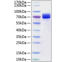 SDS-PAGE - Recombinant Human Mesothelin Protein (C-terminal Human Fc and His Tag) (A331051) - Antibodies.com