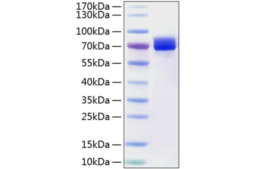 SDS-PAGE - Recombinant Human Mesothelin Protein (C-terminal Human Fc and His Tag) (A331051) - Antibodies.com