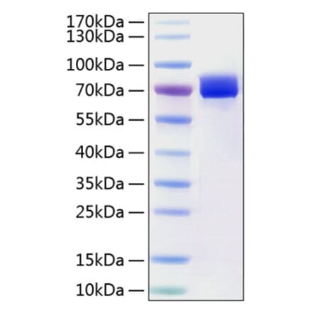 SDS-PAGE - Recombinant Human Mesothelin Protein (C-terminal Human Fc and His Tag) (A331051) - Antibodies.com