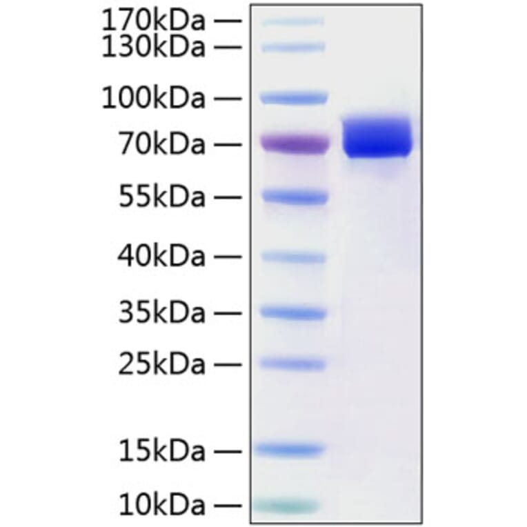 SDS-PAGE - Recombinant Human Mesothelin Protein (C-terminal Human Fc and His Tag) (A331051) - Antibodies.com