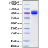 SDS-PAGE - Recombinant Human Mesothelin Protein (C-terminal Human Fc and His Tag) (A331051) - Antibodies.com