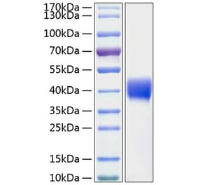 SDS-PAGE - Recombinant Human Mesothelin Protein (C-terminal His Tag) (A331052) - Antibodies.com
