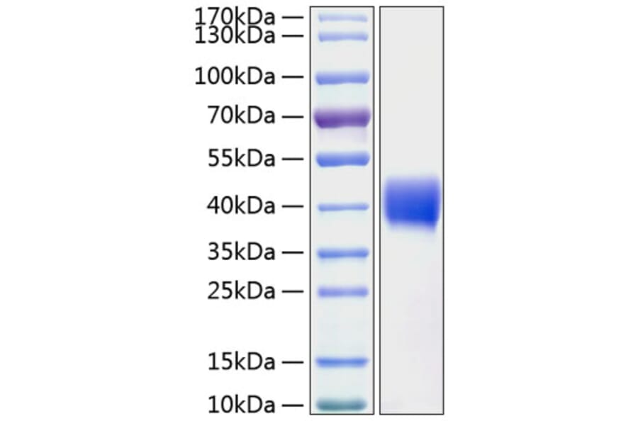 SDS-PAGE - Recombinant Human Mesothelin Protein (C-terminal His Tag) (A331052) - Antibodies.com
