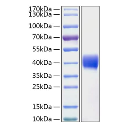 SDS-PAGE - Recombinant Human Mesothelin Protein (C-terminal His Tag) (A331052) - Antibodies.com