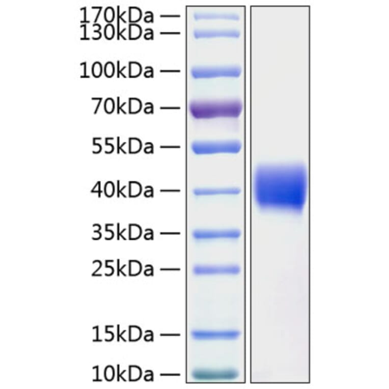 SDS-PAGE - Recombinant Human Mesothelin Protein (C-terminal His Tag) (A331052) - Antibodies.com