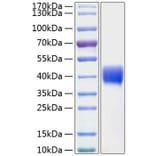 SDS-PAGE - Recombinant Human Mesothelin Protein (C-terminal His Tag) (A331052) - Antibodies.com