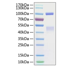 SDS-PAGE - Recombinant Human Met (c-Met) Protein (C-terminal His Tag) (A331053) - Antibodies.com