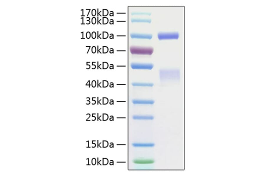SDS-PAGE - Recombinant Human Met (c-Met) Protein (C-terminal His Tag) (A331053) - Antibodies.com