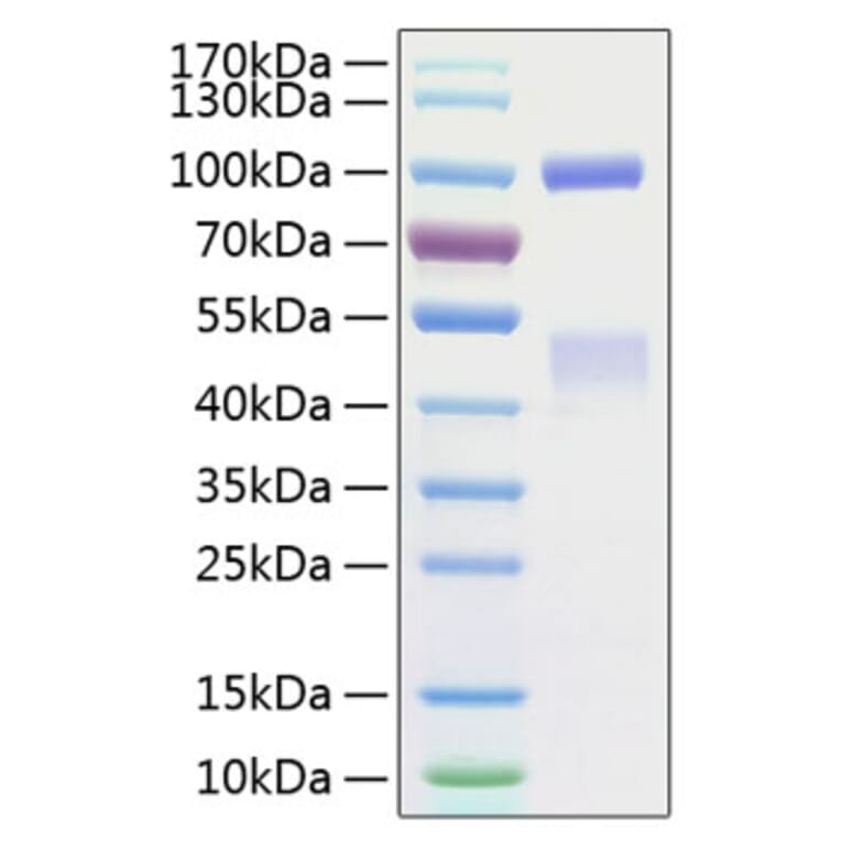 SDS-PAGE - Recombinant Human Met (c-Met) Protein (C-terminal His Tag) (A331053) - Antibodies.com