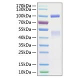 SDS-PAGE - Recombinant Human Met (c-Met) Protein (C-terminal His Tag) (A331053) - Antibodies.com
