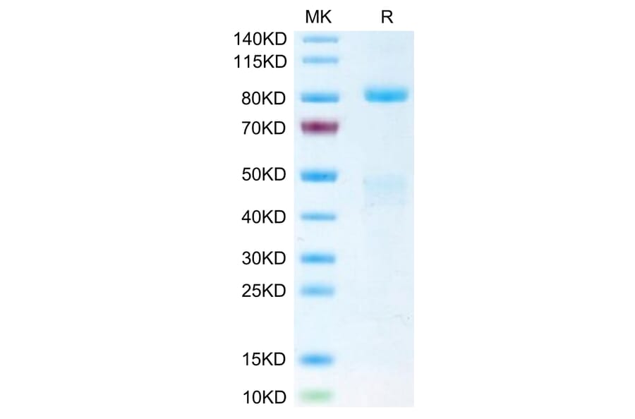 Tris-Bis PAGE - Recombinant Human Met (c-Met) Protein (Biotin) (C-terminal His and Avi Tag) (A331054) - Antibodies.com