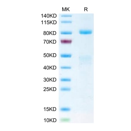 Tris-Bis PAGE - Recombinant Human Met (c-Met) Protein (Biotin) (C-terminal His and Avi Tag) (A331054) - Antibodies.com
