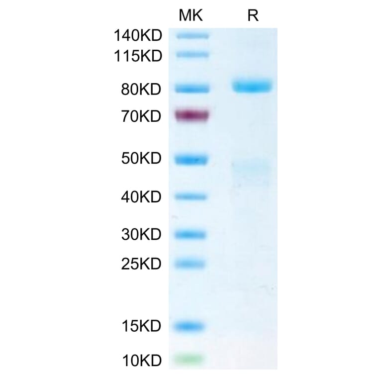 Tris-Bis PAGE - Recombinant Human Met (c-Met) Protein (Biotin) (C-terminal His and Avi Tag) (A331054) - Antibodies.com