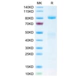 Tris-Bis PAGE - Recombinant Human Met (c-Met) Protein (Biotin) (C-terminal His and Avi Tag) (A331054) - Antibodies.com