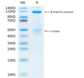 Tris-Bis PAGE - Recombinant Human Met (c-Met) Protein (C-terminal Human Fc Tag) (A331055) - Antibodies.com