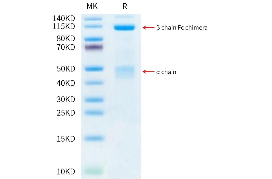 Tris-Bis PAGE - Recombinant Human Met (c-Met) Protein (C-terminal Human Fc Tag) (A331055) - Antibodies.com
