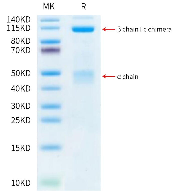 Tris-Bis PAGE - Recombinant Human Met (c-Met) Protein (C-terminal Human Fc Tag) (A331055) - Antibodies.com