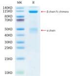 Tris-Bis PAGE - Recombinant Human Met (c-Met) Protein (C-terminal Human Fc Tag) (A331055) - Antibodies.com