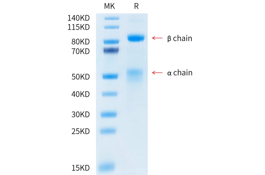Tris-Bis PAGE - Recombinant Human Met (c-Met) Protein (C-terminal His and Avi Tag) (A331056) - Antibodies.com