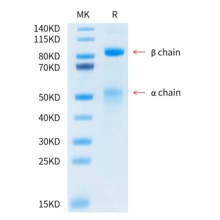 Tris-Bis PAGE - Recombinant Human Met (c-Met) Protein (C-terminal His and Avi Tag) (A331056) - Antibodies.com