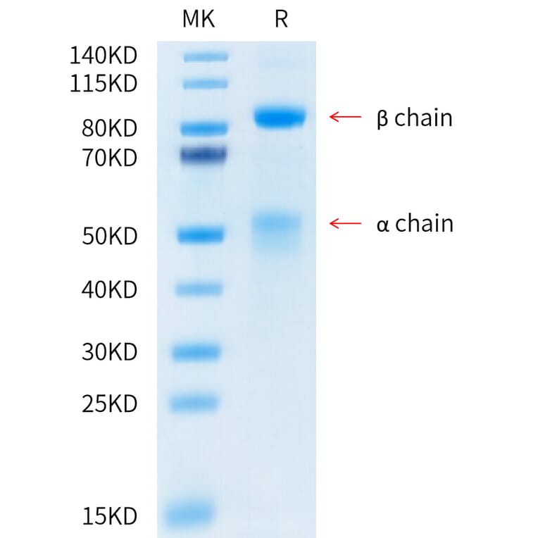 Tris-Bis PAGE - Recombinant Human Met (c-Met) Protein (C-terminal His and Avi Tag) (A331056) - Antibodies.com