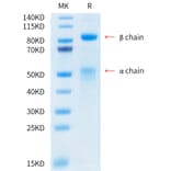 Tris-Bis PAGE - Recombinant Human Met (c-Met) Protein (C-terminal His and Avi Tag) (A331056) - Antibodies.com