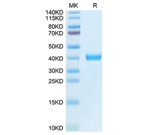 Tris-Bis PAGE - Recombinant Human MFAP4 Protein (N-terminal His and Flag Tag) (A331057) - Antibodies.com