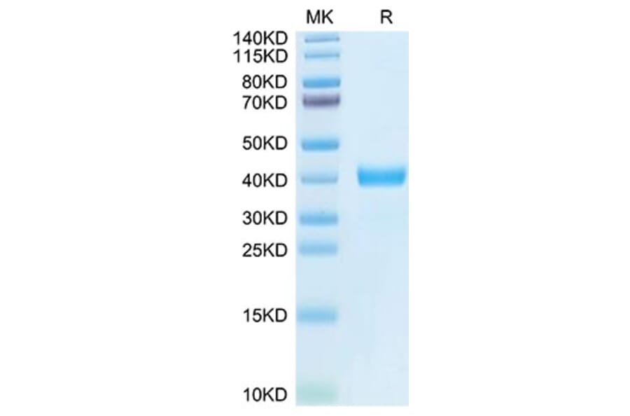 Tris-Bis PAGE - Recombinant Human MFAP4 Protein (N-terminal His and Flag Tag) (A331057) - Antibodies.com