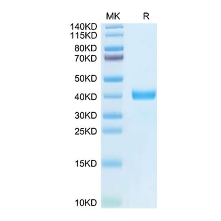Tris-Bis PAGE - Recombinant Human MFAP4 Protein (N-terminal His and Flag Tag) (A331057) - Antibodies.com