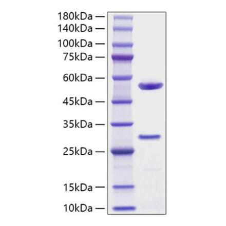 SDS-PAGE - Recombinant Human MFAP5 Protein (C-terminal His Tag) (A331058) - Antibodies.com