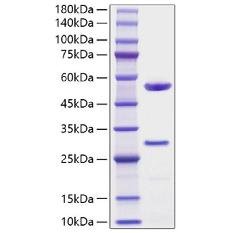 SDS-PAGE - Recombinant Human MFAP5 Protein (C-terminal His Tag) (A331058) - Antibodies.com