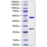 SDS-PAGE - Recombinant Human MFAP5 Protein (C-terminal His Tag) (A331058) - Antibodies.com