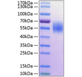 SDS-PAGE - Recombinant Human MICA Protein (C-terminal His Tag) (A331059) - Antibodies.com