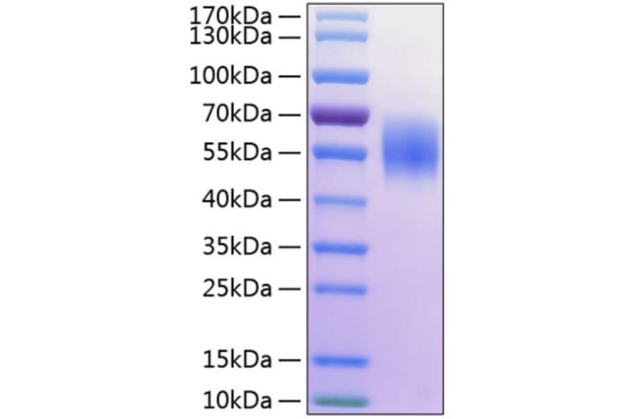 SDS-PAGE - Recombinant Human MICA Protein (C-terminal His Tag) (A331059) - Antibodies.com