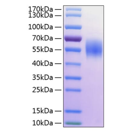 SDS-PAGE - Recombinant Human MICA Protein (C-terminal His Tag) (A331059) - Antibodies.com