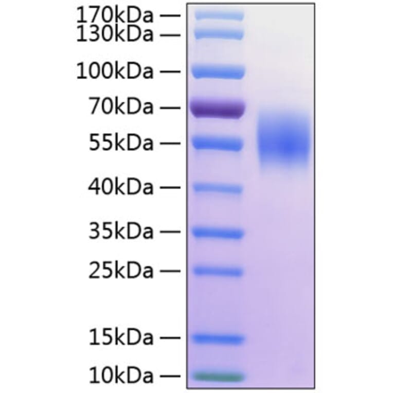 SDS-PAGE - Recombinant Human MICA Protein (C-terminal His Tag) (A331059) - Antibodies.com